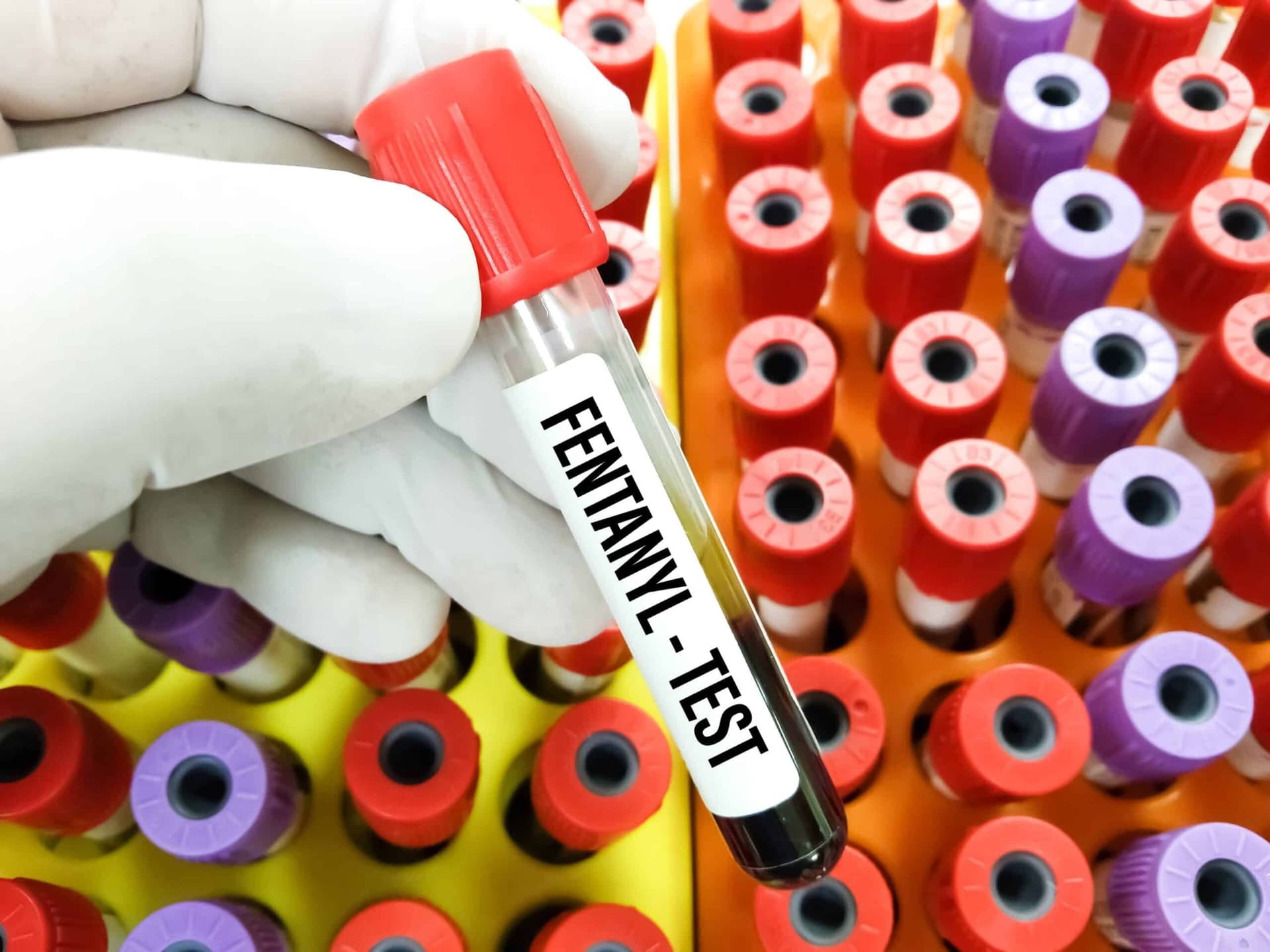The Role of Fentanyl Test Kits in Modern Addiction Treatment Centers